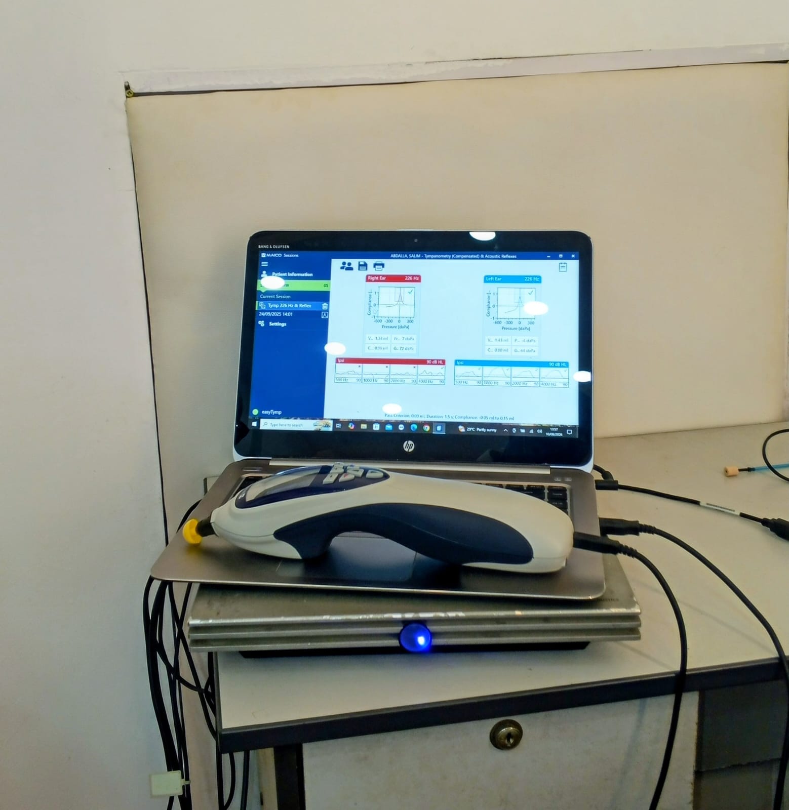Tympanometry and acoustic reflex results for both ears displayed on the clinical software